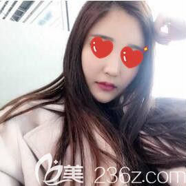 做玻尿酸全面部填充術后15天恢復效果 做玻尿酸全面部填充術后15天恢復效果