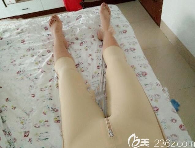 衛(wèi)愛(ài)俠大腿抽脂第4天照片 衛(wèi)愛(ài)俠大腿抽脂第4天照片