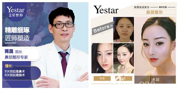 蔣晟院長(zhǎng)鼻部整形案例