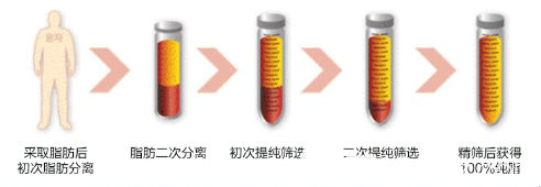 廣州紫馨梁進(jìn)華醫(yī)生自體脂肪萃取技術(shù)優(yōu)勢 廣州紫馨梁進(jìn)華醫(yī)生自體脂肪萃取技術(shù)優(yōu)勢