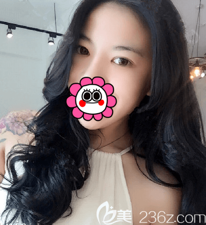 北京上上相做修復(fù)雙眼皮效果很吸睛我就果斷找龐東亮做了定點(diǎn)雙眼皮