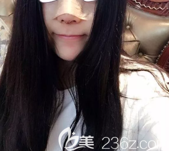 德州做鼻綜合術(shù)后第五天的樣子 德州做鼻綜合術(shù)后第五天的樣子