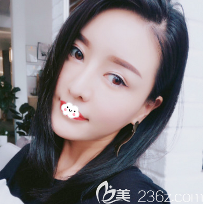 看深圳美萊梁曉健鼻子做得怎么樣 看深圳美萊梁曉健鼻子做得怎么樣