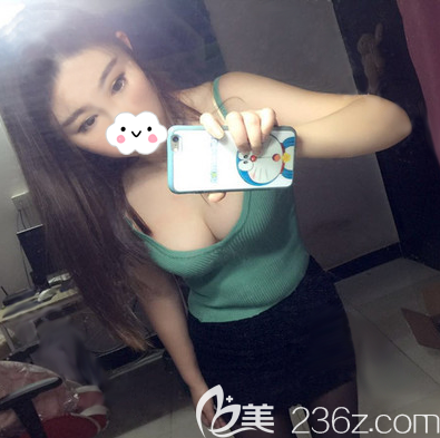 看到成都天姿（原恒博）李烈的自體脂肪豐胸案例，我專門從南京跑到成都做了豐胸手術