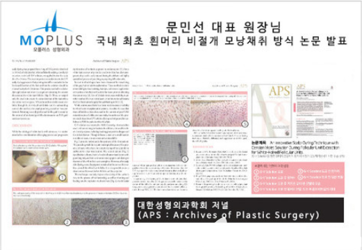 文珉善院長發(fā)表的論文 文珉善院長發(fā)表的論文