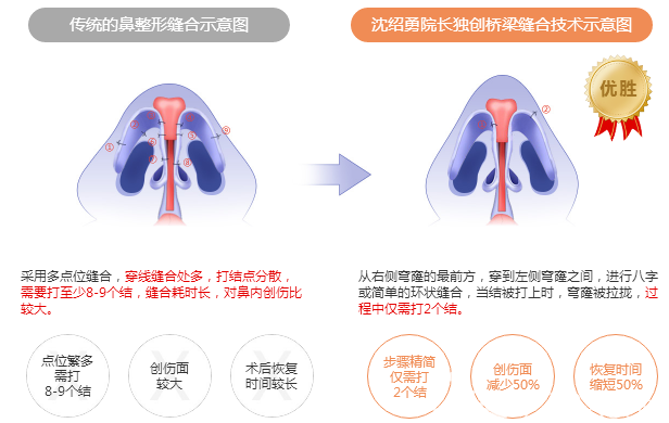 廣州紫馨沈紹勇做鼻子怎么樣