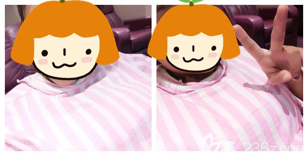 剛做完威寧之星假體隆胸術(shù)后即刻效果