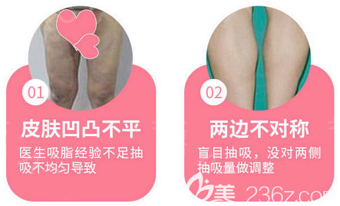 吸脂失敗了怎么辦