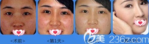 做激光祛斑<span style=