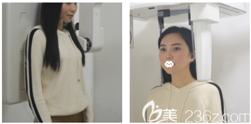 在廣州紫馨做隆胸和隆鼻術(shù)前照片 在廣州紫馨做隆胸和隆鼻術(shù)前照片