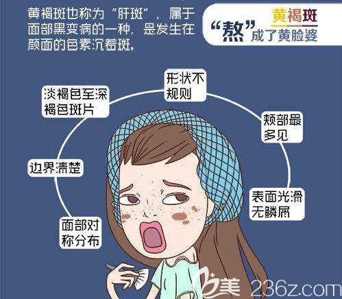 黃褐斑在臉上的表現(xiàn)形式 黃褐斑在臉上的表現(xiàn)形式