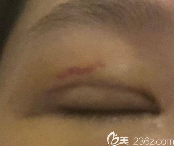 20190731_1564559992230309.png 20190731_1564559992230309.png