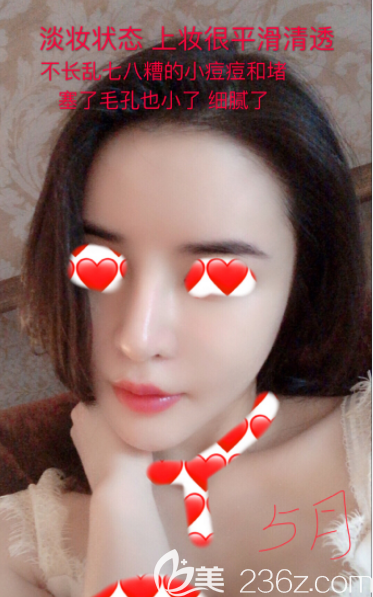 韓國蕾切爾皮膚管理怎么樣