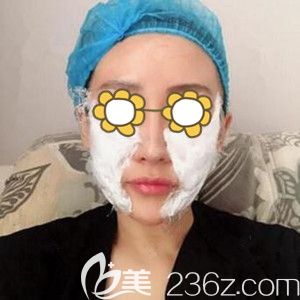 做埋線提升術前敷麻藥 做埋線提升術前敷麻藥