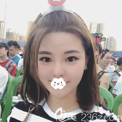 成都艾米麗潘紅偉注射瘦臉3個月效果 成都艾米麗潘紅偉注射瘦臉3個月效果