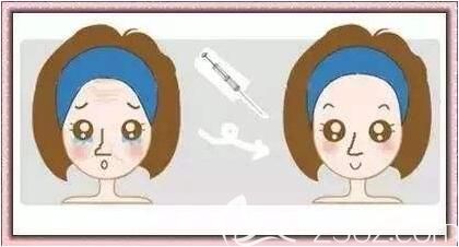 注射玻尿酸除皺效果怎么樣？好不好？