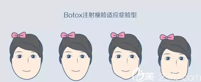 適合注射瘦臉的臉部特征