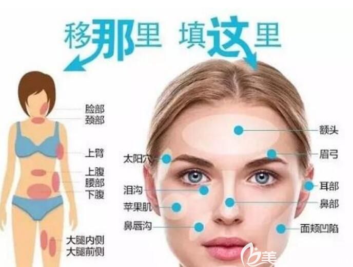 自體脂肪功能介紹