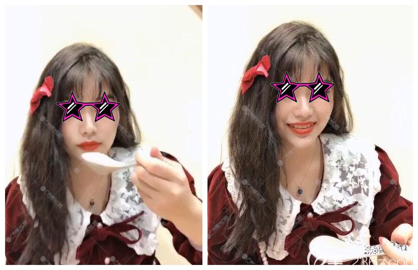 廣州曙光口腔初戴牙套體驗(yàn)