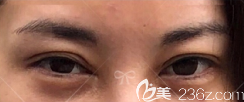 20190805_1564993828538035.png image.png