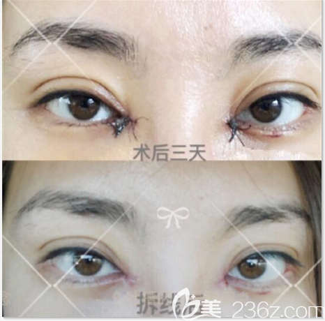 20190805_1564995847839292.png image.png