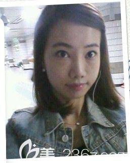 脂肪移植 那木整形