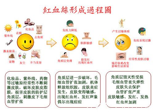 形成紅血絲的具體原因