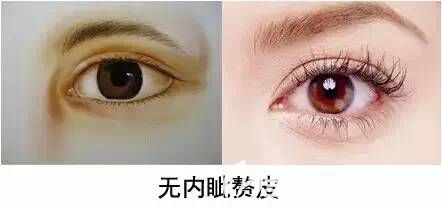 無內眥贅皮圖解