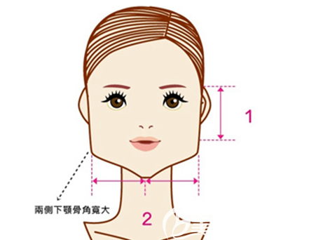 腮幫子大想做磨腮削骨手術(shù)