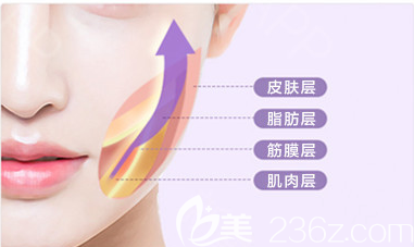 面部拉皮手術