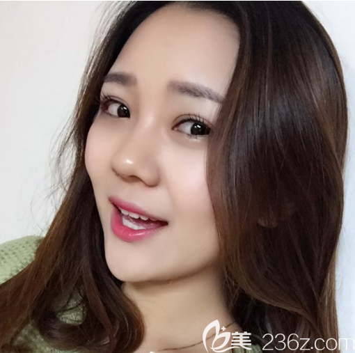 切開(kāi)法雙眼皮打卡韓國(guó)奧斯卡(Oscar)白勝旭一切都在案例中表達(dá)