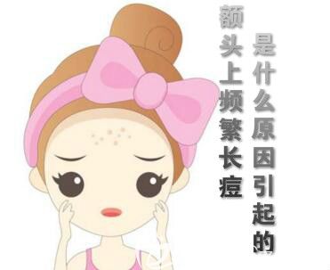 額頭上頻繁長(zhǎng)痘的原因