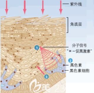 面部產生黑色素的具體層次