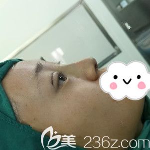 剛做完翹睫美瞳術(shù)和<span style= 剛做完翹睫美瞳術(shù)和<span style=