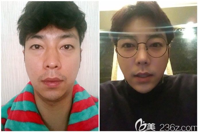 韓國愛琳金明轍案例 韓國愛琳金明轍案例