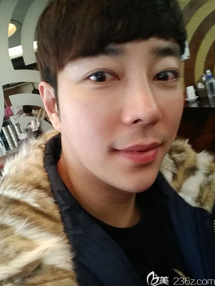 韓國愛琳金明轍眼鼻輪廓術讓一位大叔成功變男神