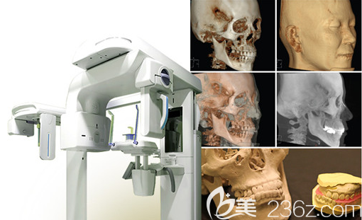 韓國巴諾巴奇3D掃描儀