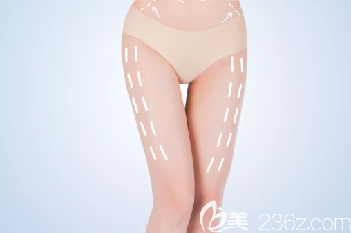 大腿吸脂后要換不同效果的塑身衣嗎