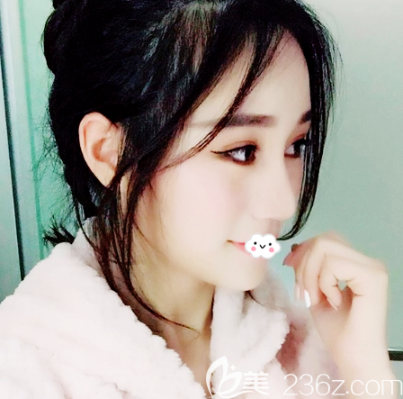 廣州軍美王世虎做面部吸脂術(shù)后兩周消腫