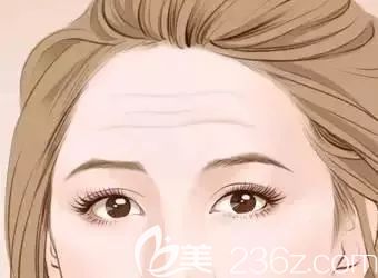 出現(xiàn)額頭皺紋的面部情況