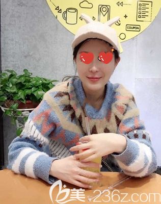 南陽維多利亞自體脂肪面部填充術(shù)后45天