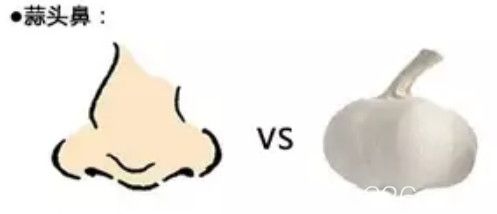蒜頭鼻的形狀