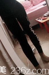 365mc大腿吸脂真人案例