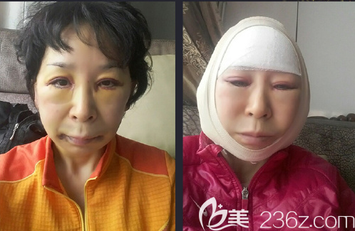 20190809_1565341237774187.png image.png