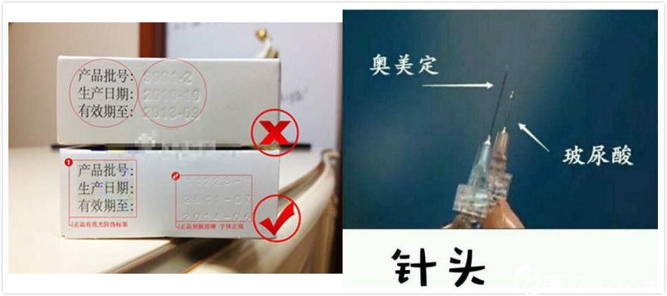 玻尿酸和奧美定區(qū)分介紹