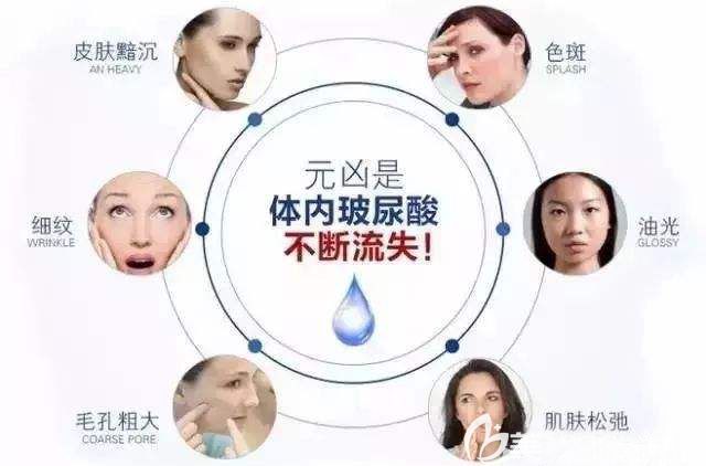 玻尿酸可解決的皮膚問(wèn)題