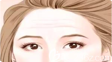 額部有皺紋展示圖