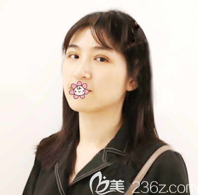 雙眼皮術后7天拆線效果 雙眼皮術后7天拆線效果