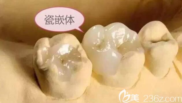 徐路路口腔知識(shí)科普