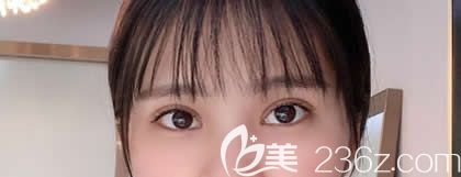 朋友都說我在西寧康華醫(yī)院做的全切雙眼皮恢復(fù)神速，現(xiàn)在把術(shù)后快速恢復(fù)技巧告訴大家